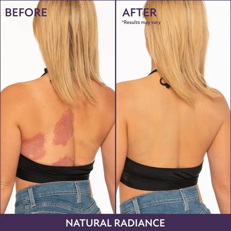 🌞Fris De Lente In Met 50% Korting!✨ Body Coverage Perfector + Extra Grote Bufferkwast | 12h Waterdicht | Camoufleert Tatoeages/Littekens | Perfect voor Foto’s! - Image 7