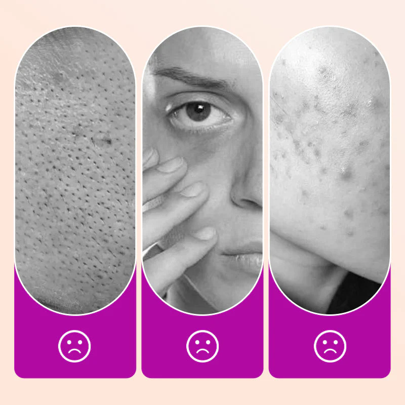 🔥Koop er 2 en krijg er 1 gratis🔥Flawless verhelderende concealer voor onder de ogen - Image 6