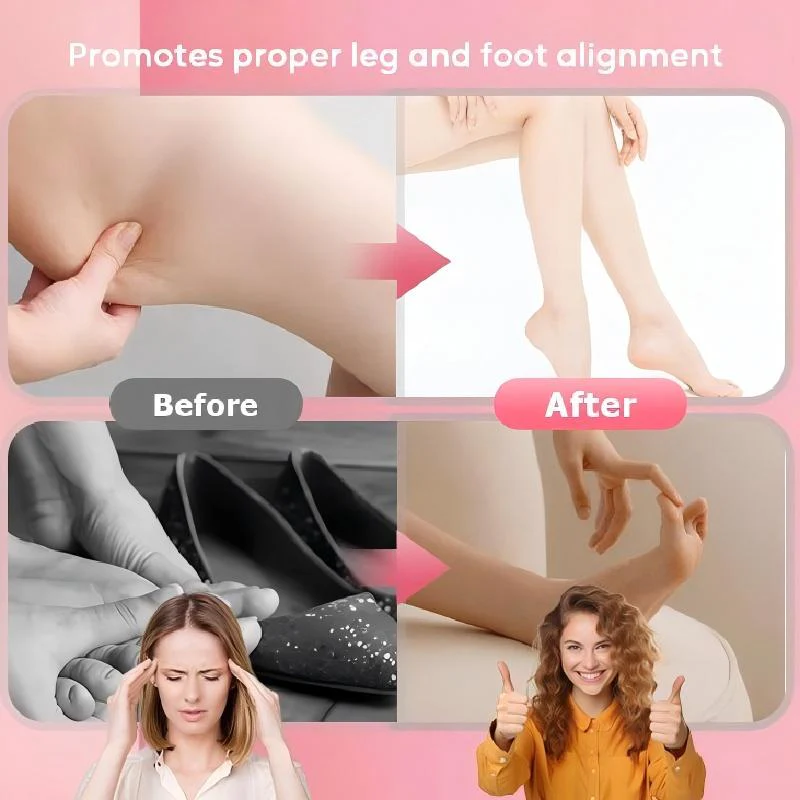 ✨ Voetboogtrainer voor Beenvorm Verbetering – All-in-één Ondersteuning, Huidvriendelijk TPR & Draagbaar (Discreet Training Thuis & Buiten!) - Image 2