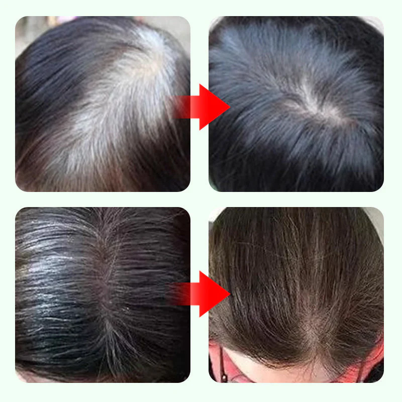 ⚡️👩‍🦳 Tijdelijke Grijze Haarverfstift – Snelle Dekking, Precisiepen & Natuurlijk Uitstraling（50% Korting, Perfect voor Touch-Ups!） - Image 7